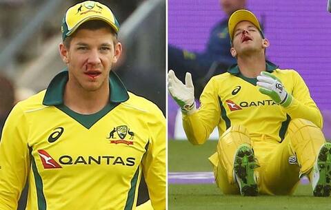 ઓસ્ટ્રેલિયાના વિકેટકિપરને મોં પર વાગ્યો બોલ, લોહી નીકળતાં લેવા પડ્યા ટાંકા છતાં ન છોડ્યું મેદાન, જાણો વિગતે ઓસ્ટ્રેલિયાના વિકેટકિપરને મોં પર વાગ્યો બોલ, લોહી નીકળતાં લેવા પડ્યા ટાંકા છતાં ન છોડ્યું મેદાન, જાણો વિગતે