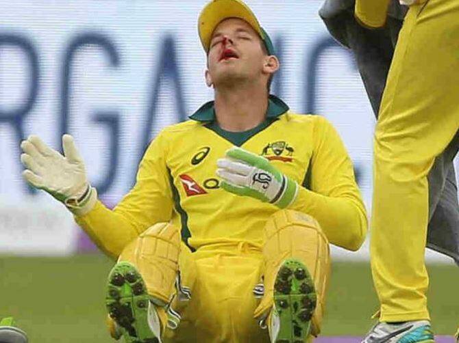 જેના કારણે તેના નાકમાંથી લોહી વહેવા લાગ્યું. તેમ છતાં પેને મેદાન ન છોડ્યુ અને વિકેટકિપિંગ કરીને શાનદાર કેચ પકડ્યો હતો.