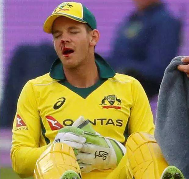 આ ઘટના ઈંગ્લેન્ડની ઈનિંગની 36મી ઓવરમાં બની હતી. એન્ડ્રયુ ટાઈએ ફેંક્લો લેગ સાઇડનો બોલ પકડવા જતી વખતે જ્યારે વિકેટકિપર ટિમ પેને ડાઇવ લગાવી ત્યારે બોલ જમીન પર પડ્યા બાદ અચાનક ઉછળ્યો અને પેનના મોં સાથ અથડાયો.