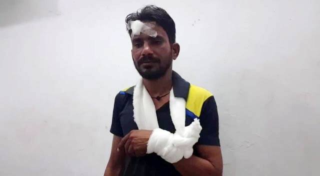 આ કપલને અટકાવાતાં ઉગ્ર બોલાચાલી થઈ ગઈ હતી અને આ કપલના મિત્રો આવી જતાં તેમણે સિક્યુરિટી ગાર્ડ સાથે મારામારી શરૂ કરી દીધી હતી. જેને કારણે સિક્યુરીટી ગાર્ડને હાથ અને અન્ય જગ્યાએ ઇજાઓ થઈ હતી.