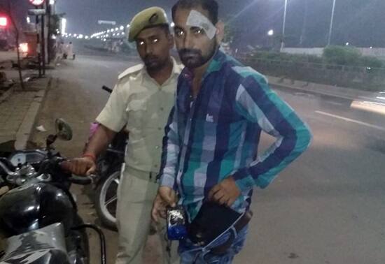 વસ્ત્રાલમાં રહેતો સોનુ ભૂપ નામનો યુવક રવિવારે રાત્રે પોતાનું બાઈક લઈને જઈ રહ્યો હતો. તે દરમિયાન તેણે પોતાનો સ્માર્ટફોન જીન્સના પેન્ટના ખિસ્સામાં રાખેલો ફોન અચાનક બ્લાસ્ટ થયો હતો. સોનુએ આ ફોન ચાર મહિના પહેલા ઓનલાઇન ખરીદ્યો હતો.