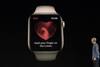 મોટા ડિસ્પ્લે સાથે Appleની નવી સ્માર્ટવોચ લોન્ચ, જાણો ફીચર્સ અને કિંમત