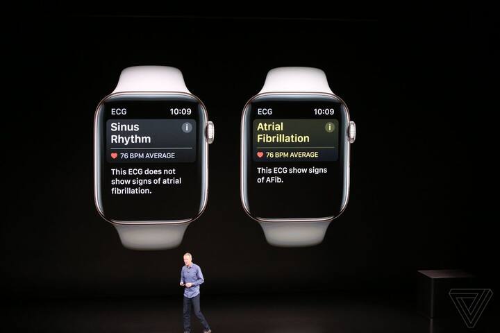 સીરિઝ 4 એપલ વોચના જીપીએસ મોડેલની કિંમત અંદાજે 28670 રૂપિયા છે જ્યારે સેલ્યુલર મોડેલની કિંમત અંદાજે 35855 રૂપિયા રાખવામાં આવી છે. એપલ વોચનું પ્રી-ઓર્ડર 14 સપ્ટેમ્બરથી શરૂ થશે અને શિપિંગ 21 સપ્ટેમ્બરથી શરૂ થશે.