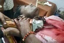 સુરતમાં કારીગરની છાતીમાં ઘૂસી ગયું ગ્રાઈન્ડર મશીન, તસવીરો જોઈને ચોંકી જશો