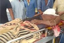 સુરતમાં કારીગરની છાતીમાં ઘૂસી ગયું ગ્રાઈન્ડર મશીન, તસવીરો જોઈને ચોંકી જશો