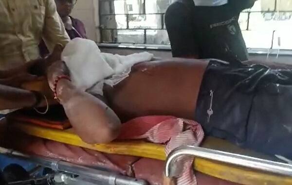 હાલ કારીગર ભીમા ગંભીર રીતે ઘાયલ છે અને તેને તાત્કાલિક 108ની મદદથી ભીમાને સારવાર માટે સિવિલ ખસેડાયો છે.