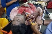 સુરત: કારીગરની છાતીમાં ઘૂસ્યું ગ્રાઈન્ડર, તસવીરો જોઈને દંગ રહી જશો