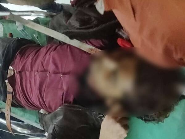 અમદાવાદ: અમદાવાદની એલ. જે. કોલેજ પાસેની એક કન્સટ્રક્શન સાઈટની બિલ્ડીંગનાં છઠ્ઠા માળેથી લોખંડનો સળિયો નીચે પડતાં યુવાનનાં માથાથી ગળા સુધી આરપાર થઈ ગયો હતો. જે જોઈ હાજર સૌ કોઈ ચોંકી ગયા હતાં. ઈજાગ્રસ્ત યુવાનને તાત્કાલિક વીએસ હોસ્પિટલ ખસેડવામાં આવ્યો હતો. ન્યુરો સર્જરી વિભાગના સર્જનની ટીમે ઓપરેશન કરવામાં આવ્યું હોવાનું જાણવા મળ્યું છે. ડોક્ટરોનાં જણાવ્યાં મુજબ, યુવાનની હાલત અત્યંત ગંભીર છે છતાં તેને બચાવવાનાં તમામ પ્રયાસ કરવામાં આવી રહ્યા છે.