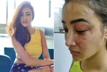 આ ટીવી એક્ટ્રેસ પર રૂમમેટે માતા સાથે મળીને કર્યો હુમલો, ચહેરાની થઈ આવી હાલત