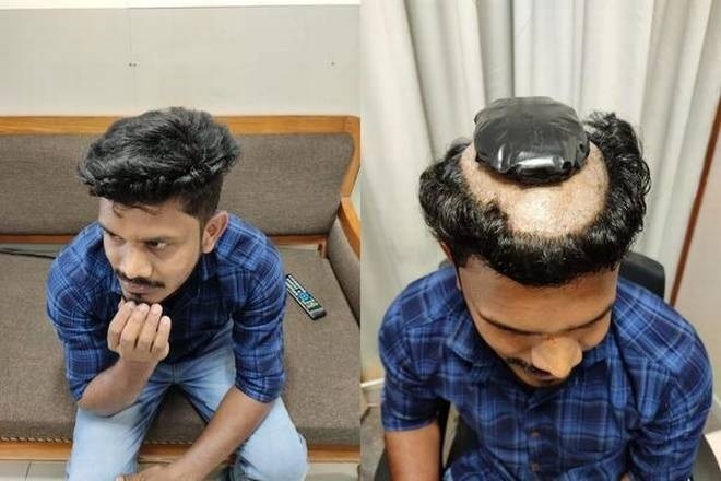 man held attempting smuggle gold hidden under wig in cochin international airport વાળની નવી સ્ટાઈલ જોઈને કસ્મટ અધિકારીને ગઈ શંકા, તપાસ કરી તો થયો ચોંકાવનારો ખુલાસો