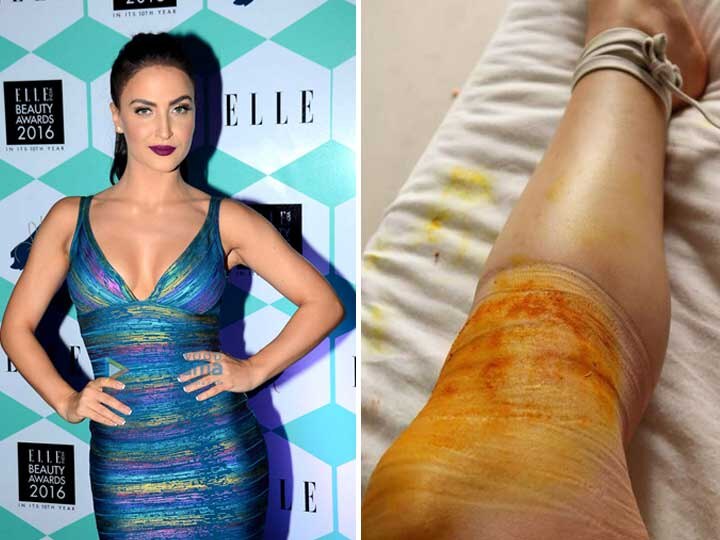 Bollywood Actress Eli Avram foot and leg damage શૂટિંગ સમયે બોલિવૂડની કઈ અભિનેત્રીને પગે અને ઘુંટણે ઈજા થઈ? જાણો વિગત