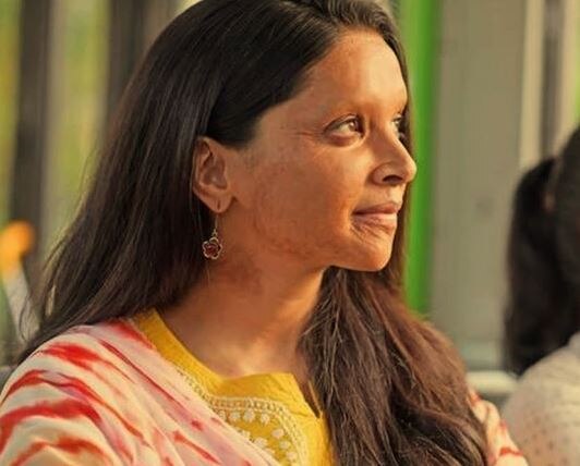 Deepika Padukone's Chhapaak declared tax free in Rajasthan રાજસ્થાન સરકારે દીપિકા પાદૂકોણની ફિલ્મ 'છપાક'ને કરી ટેક્સ ફ્રી