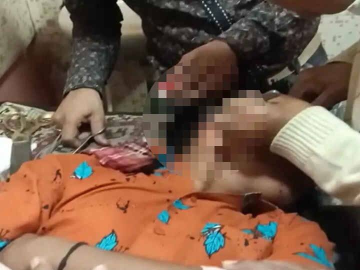 ઉત્તરાયણ પર દોરીથી ગળુ કપાવાના કેટલા કેસ નોંધાયા, 108ને કેટલા કોલ મળ્યા, જાણો વિગત 1730 Emergency cases record till 2 PM on Uttrayan ઉત્તરાયણ પર દોરીથી ગળુ કપાવાના કેટલા કેસ નોંધાયા, 108ને કેટલા કોલ મળ્યા, જાણો વિગત