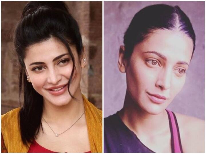 shruti haasan accepts plastic surgery writes long post for trollers શ્રુતિ હાસને કરાવી પ્લાસ્ટિક સર્જરી, તસવીર શેર કરી કહ્યું હવે આવી થઈ ગઈ છું