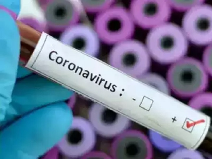 Coronavirus outbreak: know where you will do corona test in Gujarat ગુજરાતમાં કોરોનાનો ટેસ્ટ કયા કયા શહેરોમાં થઈ શકશે ? જાણો વિગત