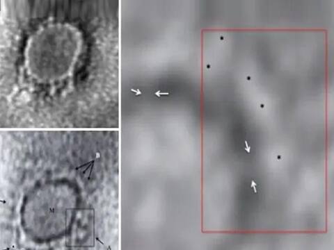Coronavirus Image: ભારતમાં કોવિડ-19ની પહેલીવાર ઈલેક્ટ્રોન માઈક્રોસ્કોપથી લીધેલી તસવીર આવી સામે