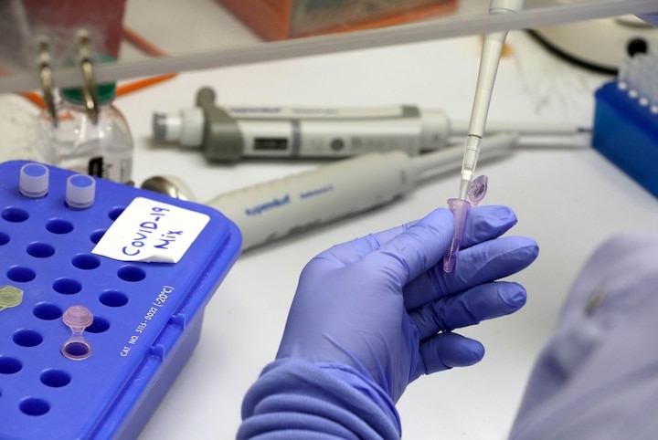 coronavirus supreme court asks centre to issue directions to approved labs for conducting covid 19 tests free of cost  COVID-19: હવે ખાનગી લેબમાં પણ ફ્રીમાં થશે કોરોનાની તપાસ, SCનો આદેશ