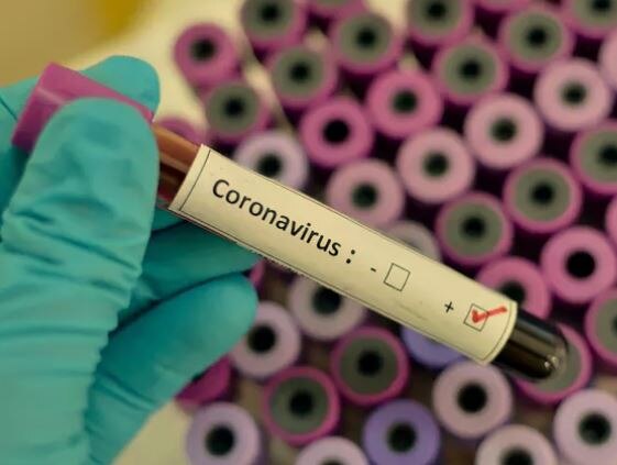 Covid 19: 33 new coronavirus cases reported and two death in gujarat રાજ્યમાં કોરોનાના વધુ 33 કેસ નોંધાયા, કુલ સંક્રમિત દર્દીઓની સંખ્યા 650 થઈ