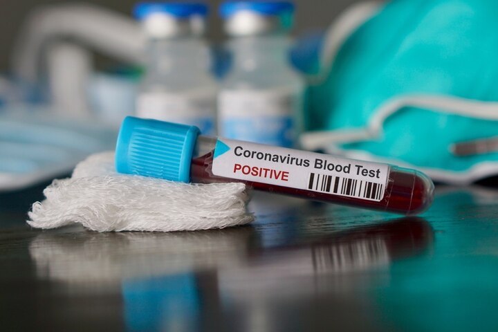 Coronavirus: china dispatched 650000 kits for India કોરોનાવાયરસઃ ચીનથી સાડા છ લાખ કિટનો જથ્થો ટૂંક સમયમાં પહોંચશે ભારત, ટેસ્ટ બનશે ઝડપી