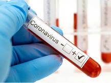 આણંદમાં કોરોનાના વધુ બે કેસ આવ્યા સામે, કુલ દર્દીઓની સંખ્યા 25 થઈ, જાણો વિગત