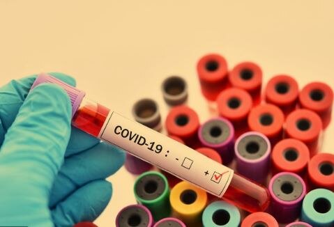 Ahemdabad reports 99 new coronavirus cases Covid19: અમદાવાદમાં નવા 99 કેસ નોંધાયા, શહેરમાં સંક્રમિત દર્દીની સંખ્યા 1101 પર પહોંચી