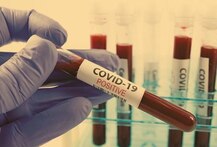 Covid 19: เช
เชฎเชฆเชพเชตเชพเชฆเชฎเชพเช เชจเชตเชพ 164 เชเซเชธ เช
เชจเซ 19 เชฎเซเชค, เชถเชนเซเชฐเชฎเชพเช เชธเชเชเซเชฐเชฎเชฟเชค เชฆเชฐเซเชฆเซเชเชจเซ เชธเชเชเซเชฏเชพ 2543