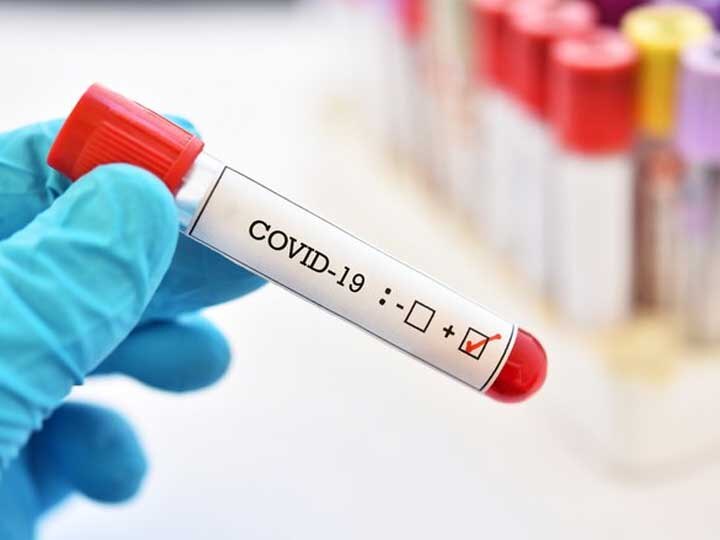 More five cases of covid-19 arrived in Valsad, 7 members of family found corona positive in Vapi વલસાડમાં એક જ પરિવારના 7 સભ્યોને લાગ્યો કોરોનાનો ચેપ, જાણો અત્યાર સુધીમાં નોંધાયા કેટલા કેસ?