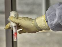 Coronavirus: તમિલનાડુમાં છેલ્લા 24 કલાકમાં 1091 કેસ, 13ના મોત, સંક્રમિતોની સંખ્યા 24 હજારને પાર