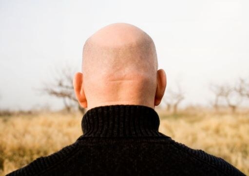 As par latest studay bald men at higher risk of covid 19 symptoms આ પુરૂષોને કોરોનાનો ચેપ લાગવાનો હોય છે વધારે ખતરો, જાણો સંશોધકો શું કહે છે ?