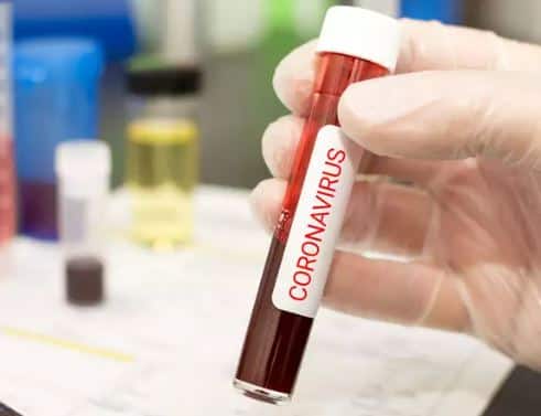 22 new coronavirus cases reported in Surat district સુરત જિલ્લામાં કોરોનાનો કહેર, આજે નવા 22 કેસ નોંધાયા, જાણો વિગત