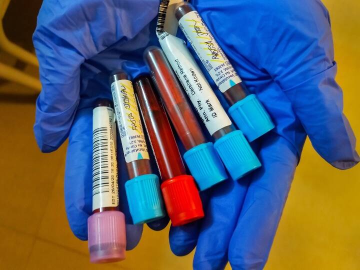 28 new coronavirus cases in last 24 hours in rural Ahmedabad અમદાવાદ ગ્રામ્ય વિસ્તારમાં વધ્યો કોરોનાનો વ્યાપ, છેલ્લા 24 કલાકમાં નવા 28 કેસ