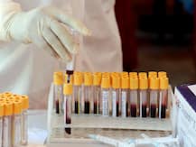 દિલ્હીમાં ફરી તૂટ્યો કોરોના વાયરસનો રેકોર્ડ, 24 કલાકમાં સૌથી વધુ મોત અને નવા કેસ