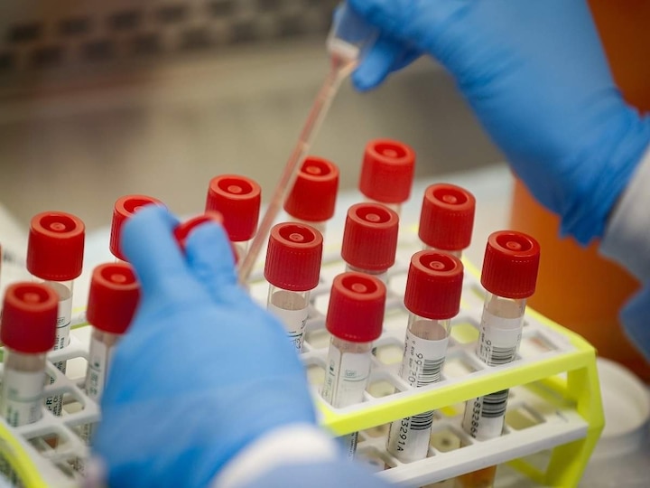 ICMR approved indian company for antigen test kits કોરોનાના એન્ટીજન રેપિડ ટેસ્ટ માટે સ્વદેશી કિટને મળી મંજૂરી, જાણો કેટલી છે કિંમત
