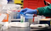 કોરોનાની વેક્સીન સૌથી પહેલાં બનાવવામાં ક્યો દેશ મારી ગયો બાજી, જાણો શું કરી જાહેરાત