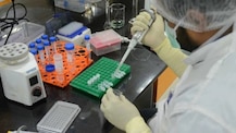 Corona Vaccine: DGCIએ સીરમ ઈન્સ્ટીટ્યૂટ પાસે ક્લિનિકલ ટ્રાયલ અંગે માંગ્યુ સ્પષ્ટીકરણ, જાણો શું છે મામલો