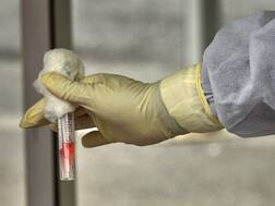 સુરત શહેરમાં કોરોના નવા 217 કેસ નોંધાયા, 6 લોકોના થયા મોત