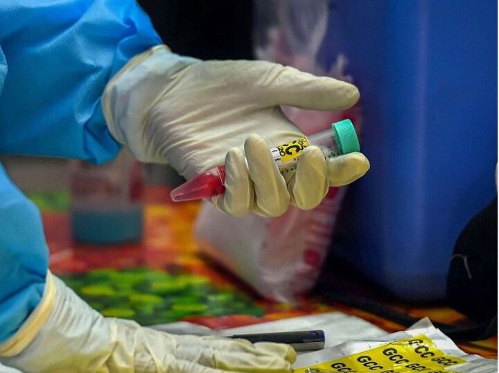 8 coronavirus case reported in diu સંઘપ્રદેશ દીવમાં કોરોનાના નવા 8 કેસ નોંધાયા, અત્યાર સુધીમાં 44 દર્દીઓએ કોરોનાને આપી મ્હાત
