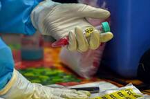 Corona Vaccine: રશિયામાં આમ જનતાને મળી કોરોના વેક્સીનની પ્રથમ બેચ, ભારત સહિત પાંચ દેશોમાં થશે ક્લિનિકલ ટ્રાયલ