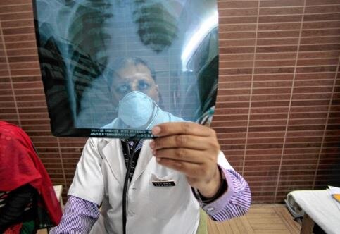  24 lakh Tuberculosis patients in India Rajyasabha MP statement ભારતમાં ટીબીના કેટલા દર્દીઓ છે ? આંકડો જાણીને ચોંકી જશો