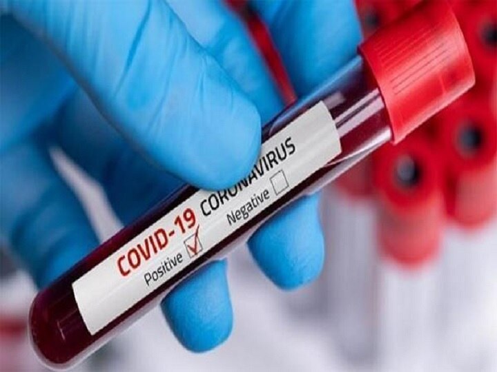 819 patients recovered in the state today Coronavirus: રાજ્યમાં આજે 819 દર્દી સ્વસ્થ થયા, રિકવરી રેટ 91.09 ટકા