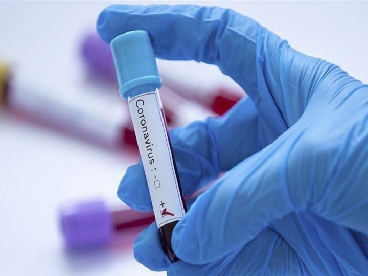 Ahmedabad corona latest : People line for RT PCR test for corona ગુજરાતમાં કોરોનાનો વિસ્ફોટઃ કયા શહેરમાં RT-PCR ટેસ્ટ માટે લેબોરેટરીમાં લાગી લાઇન?