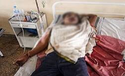 સુરતઃ મિત્રોએ ચડાવતાં યુવકે મોંઢામાં ફોડ્યો સૂતળી બોમ્બ, હોઠના ઉડ્યા ફૂરચા, જાણો લેવા પડ્યા કેટલા ટાંકા ?