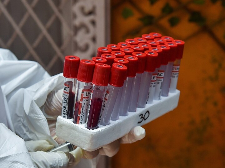 uttar pradesh makes record of maximum corona tests more than two crore tests done in state કોરોના ટેસ્ટ મામલે આ રાજ્યએ બનાવ્યો રેકોર્ડ, બે કરોડથી વધુ ટેસ્ટ કરનાર પ્રથમ રાજ્ય બન્યું