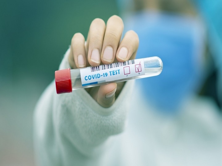 1389 covid 19 patients recovered today  Coronavirus: રાજ્યમાં આજે 1389 દર્દીઓએ કોરોનાને આપી મ્હાત, અત્યાર સુધી કુલ 2,11,603 લોકો સ્વસ્થ થયા