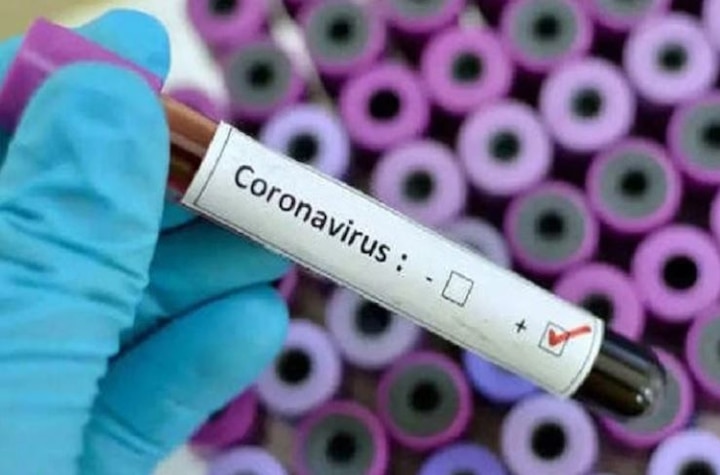 79 more cases of coronavirus in iit madras 183 have been infected  IIT મદ્રાસમાં કોરોનાના નવા 79 કેસ, અત્યાર સુધીમાં 183 થયા છે સંક્રમિત