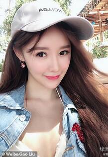 એક્ટ્રેસે કરાવી નાકની સર્જરી, અણઘડ ડોક્ટરે લોચો મારતાં થઈ ગઈ બૂચી, જુઓ કેવા થયા હાલ ?