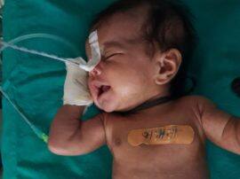 एक महीने की बच्ची के पेट में था ट्यूमर...ऑपरेशन के बाद डॉक्टर ने जो देखा रह गए हैरान एक महीने की बच्ची के पेट में था ट्यूमर...ऑपरेशन के बाद डॉक्टर ने जो देखा रह गए हैरान