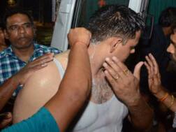 प्रयागराज: युवक ने पुलिस की टीम पर किया एसिड अटैक, 7 पुलिसकर्मी समेत 13 झुलसे