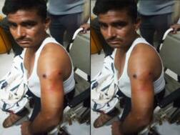 ग्रेटर नोएडा में BJP कार्यकर्ता को गोली मारकर बदमाश फरार, पुलिस जांच में जुटी