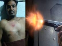 अलीगढ़ मुस्लिम यूनिवर्सिटी में निष्कासित छात्र को मारी गई गोली, आरोपी फरार